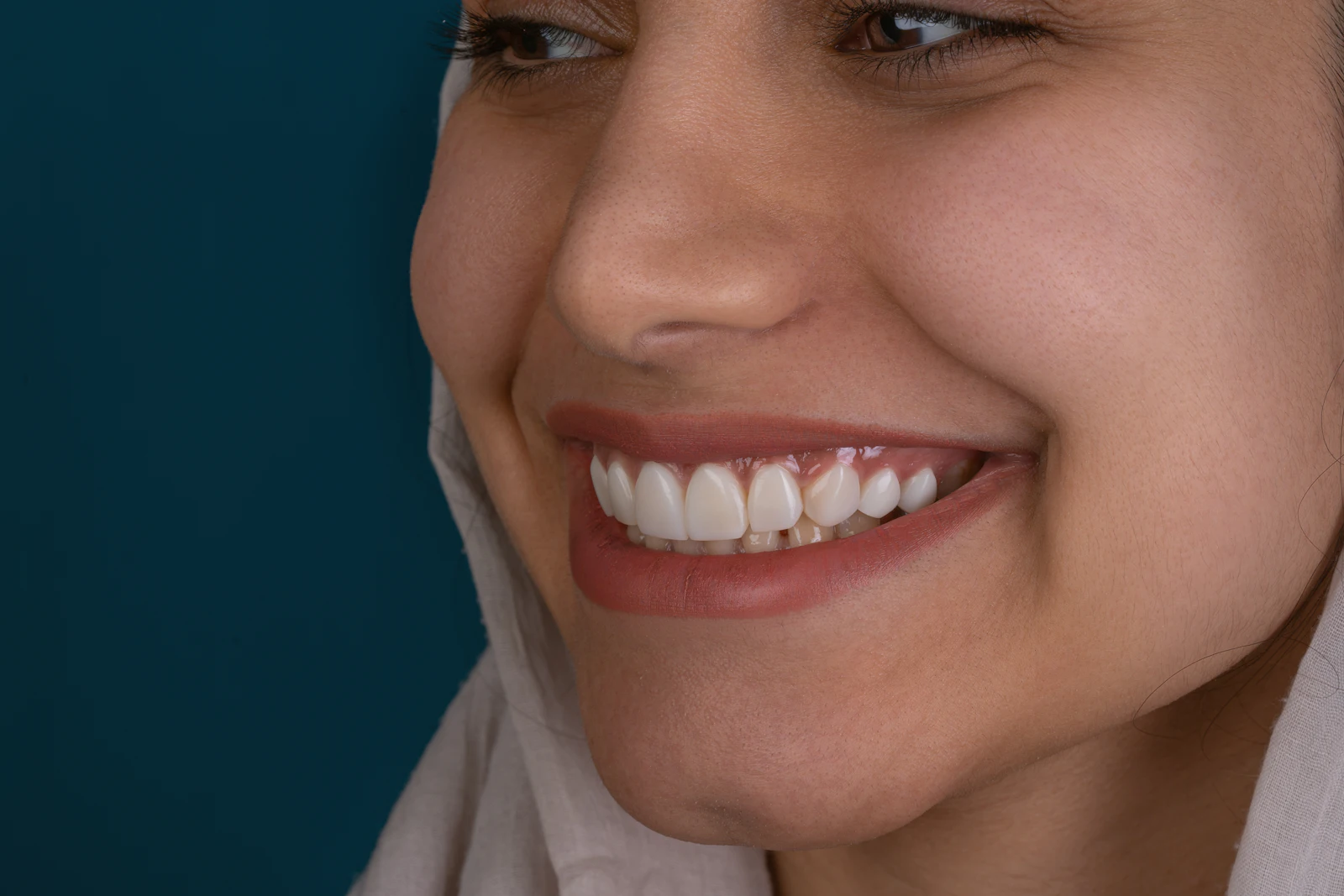 Facetas e Lentes — Odontubel